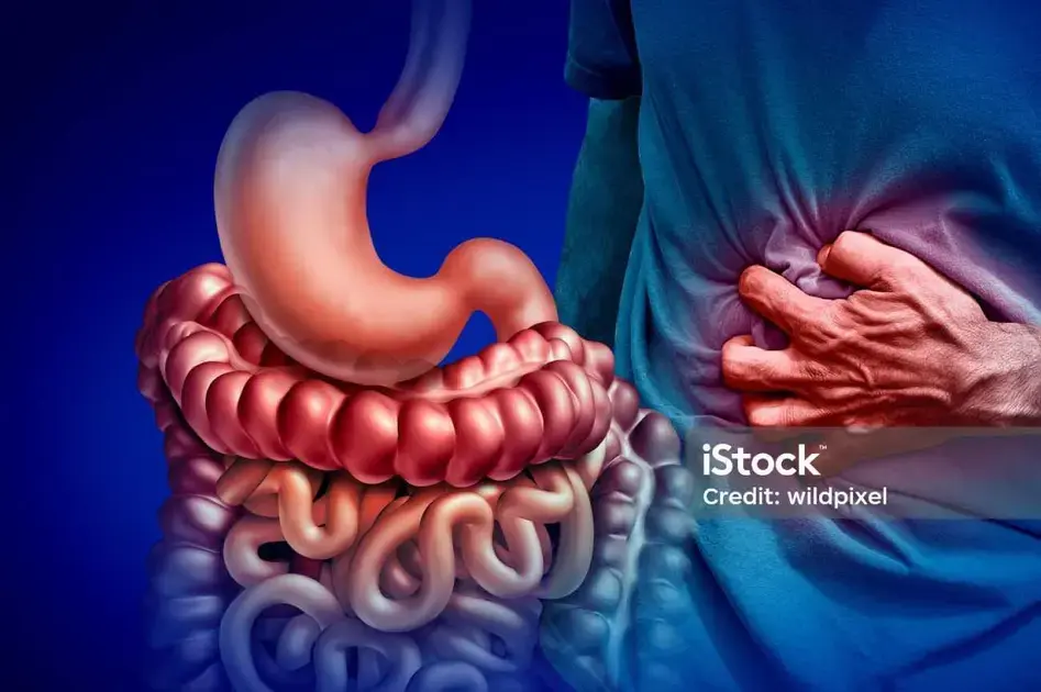 Causas e fatores de risco da síndrome do intestino irritável